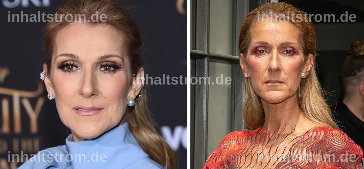 Céline Dion 2026: Gesundheitszustand, Dokumentation und Hoffnung auf ein Comeback